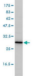 TPMT Monoclonal Antibody (1B5)
