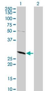 TPMT Antibody in Western Blot (WB)