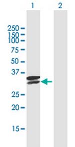 TPSAB1 Polyclonal Antibody, MaxPab™