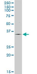 TPSAB1 Antibody in Western Blot (WB)