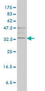 TPSAB1 Monoclonal Antibody (2A10-B5)