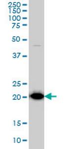 TPT1 Antibody in Western Blot (WB)