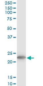 TPT1 Antibody in Western Blot (WB)