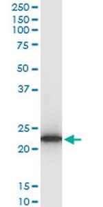 TPT1 Monoclonal Antibody (2C4)