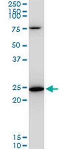 TPT1 Monoclonal Antibody (2A3)