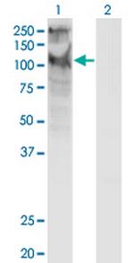 TRPC5 Monoclonal Antibody (1C8)