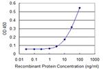TSC2 Monoclonal Antibody (1C1)