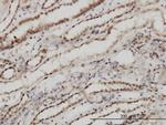 TSG101 Antibody in Immunohistochemistry (Paraffin) (IHC (P))