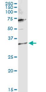 TTC1 Antibody in Western Blot (WB)