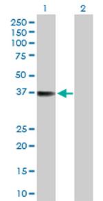 TTC1 Polyclonal Antibody, MaxPab™