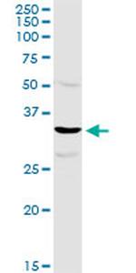 TTC1 Antibody in Western Blot (WB)
