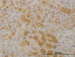TTC1 Monoclonal Antibody (4E3)