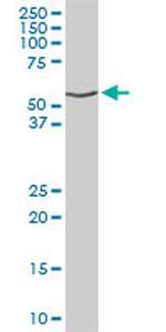 DNAJC7 Antibody in Western Blot (WB)