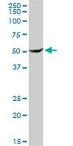 DNAJC7 Antibody in Western Blot (WB)