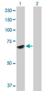 DNAJC7 Antibody in Western Blot (WB)