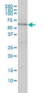 DNAJC7 Monoclonal Antibody (4G6-G3)