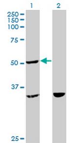 TTC4 Monoclonal Antibody (1E10)