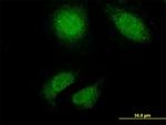 TTN Monoclonal Antibody (2B3)