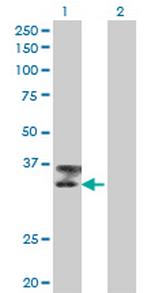 TTN Monoclonal Antibody (6H5)