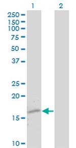 TTR Monoclonal Antibody (4D8)