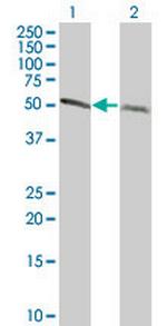 TUBA1 Antibody in Western Blot (WB)