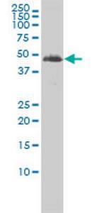 TUBA2 Monoclonal Antibody (3F10-2F2)