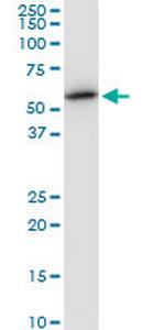TUBB2A Monoclonal Antibody (3C12)