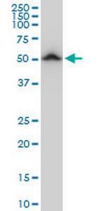 TUBB2A Monoclonal Antibody (3B2)