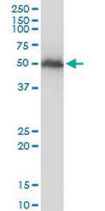 TUBB2A Monoclonal Antibody (3F9)
