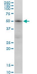 TUBB2A Monoclonal Antibody (3E7)