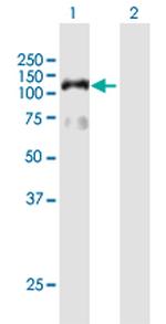 HIRA Antibody in Western Blot (WB)