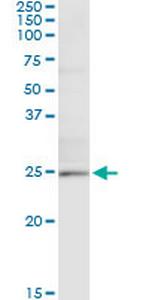 TWIST1 Antibody in Immunoprecipitation (IP)