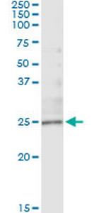 TWIST1 Monoclonal Antibody (1D3)