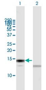 TXN Antibody in Western Blot (WB)