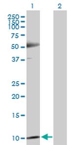 TXN Antibody in Western Blot (WB)