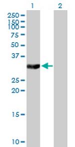 TYMS Antibody in Western Blot (WB)