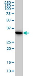 TYMS Antibody in Western Blot (WB)