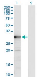 TYMS Monoclonal Antibody (2B2)