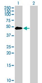 TYR Antibody in Western Blot (WB)