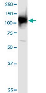 UBA1 Monoclonal Antibody (2B6)