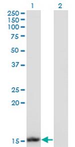 UBE2B Monoclonal Antibody (1F11)