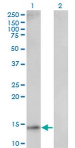 UBE2D1 Antibody in Western Blot (WB)