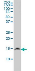 UBE2N Monoclonal Antibody (3G1-D10)