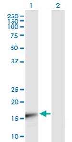 UBE2V1 Polyclonal Antibody, MaxPab™
