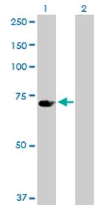UBP1 Antibody in Western Blot (WB)