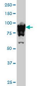 UBTF Monoclonal Antibody (6B6)