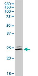 UCHL1 Antibody in Western Blot (WB)