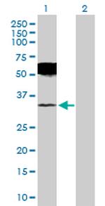 UCHL1 Antibody in Western Blot (WB)