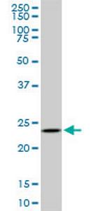 UCHL3 Monoclonal Antibody (4E9)