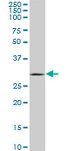 UCP1 Monoclonal Antibody (4B7)